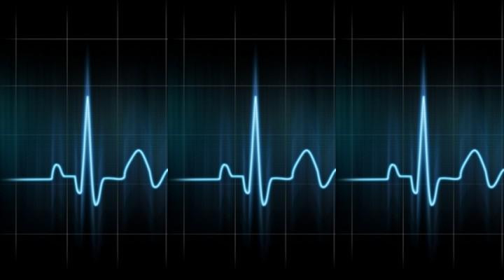 Kas ir pulsometrs un kam tas nepieciešams?